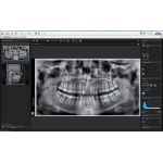 Vistapano S 2D Ceph Vistapano S 2D Ceph